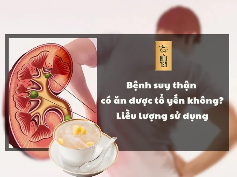 Bệnh suy thận có ăn được tổ yến không? Liều lượng sử dụng