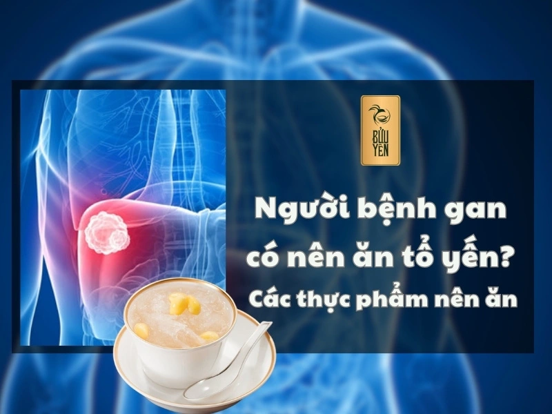 Người bệnh gan có nên ăn tổ yến? Các thực phẩm nên ăn